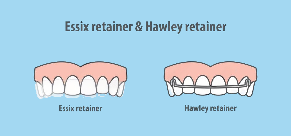 Hawley Retainer | Hawley Orthodontic Retainer