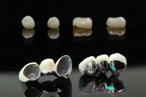 porcelain crown vs zirconia crown