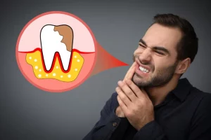 How Long Until a Tooth Infection Kills You?