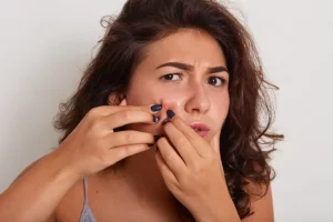 How to shrink a cystic pimple overnight