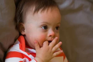 Teething Rash | Drool Rash - Oris Dental