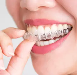 Invisalign Express