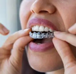 Invisalign Lite