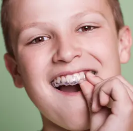 Invisalign Teen