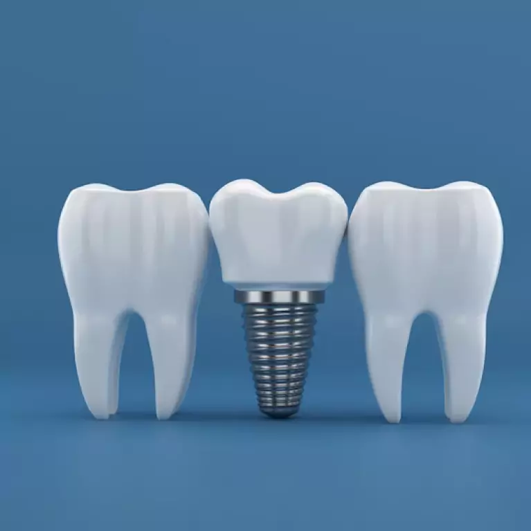 Wisdom Tooth Surgery: Postoperative Care